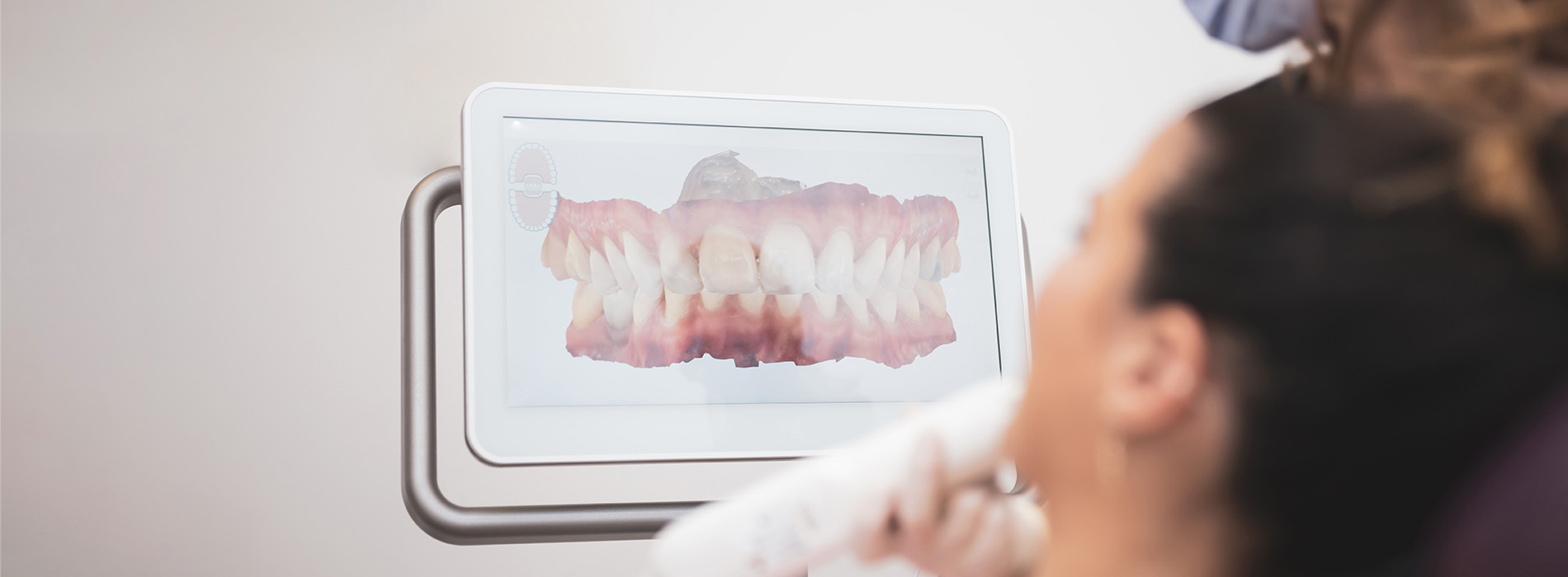 Sandra L. MacDonald, DMD | Dentures, Digital Radiography and Sleep Apnea FAQs