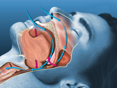 Sandra L. MacDonald, DMD | Extractions, Implant Restorations and Preventative Program