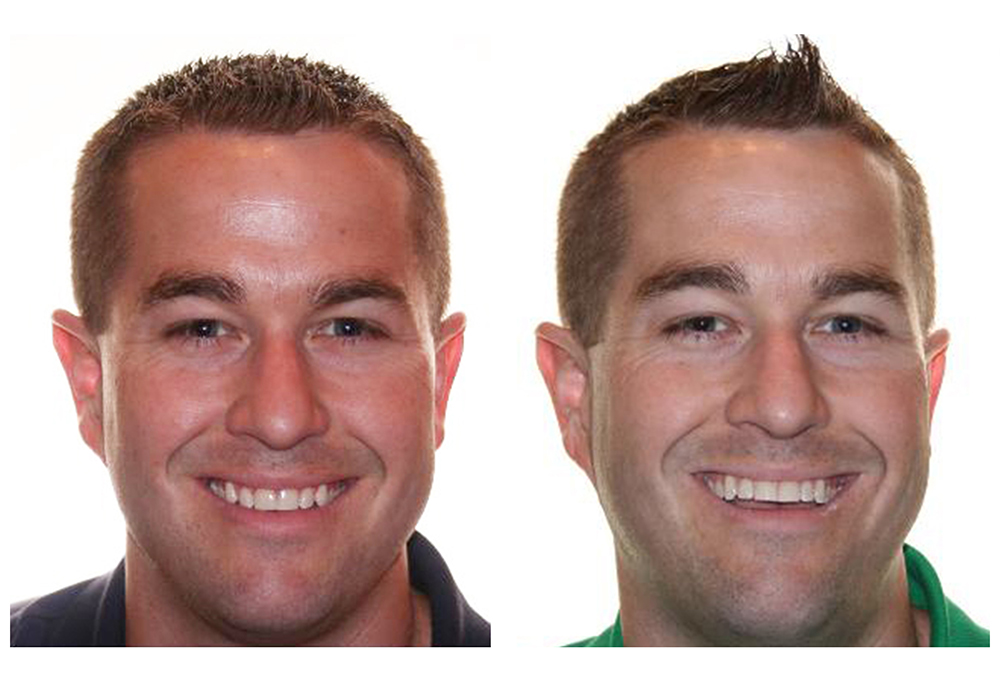 Plymouth Center for Dental Health and Wellness