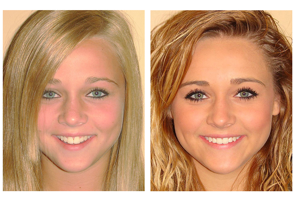 Plymouth Center for Dental Health and Wellness