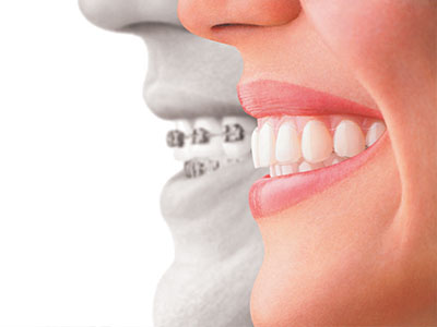 Sandra L. MacDonald, DMD | Dentures, Sleep Apnea and Periodontal Treatment