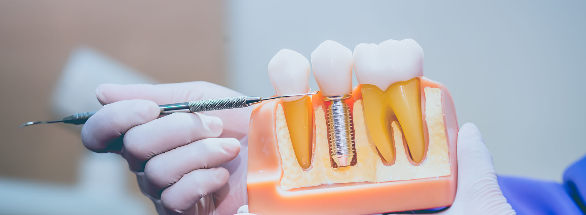 Sandra L. MacDonald, DMD | Dental Bridges, iTero   Intraoral Scanner and Periodontal Treatment